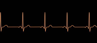 Normal bir elektrokardiyogram EKG, sağlıklı bir bireyde kalbin elektriksel aktivitesini gösteren 3 boyutlu bir çizim.
