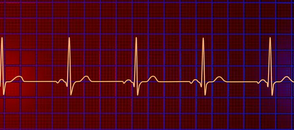 一个正常的心电图心电图 3D插图显示一个健康个体的心脏电活动 — 图库照片