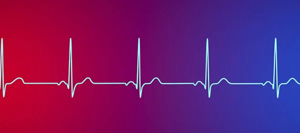 Normalny Elektrokardiogram Ekg Ilustracja Pokazująca Aktywność Elektryczną Serca Zdrowej Osoby — Zdjęcie stockowe