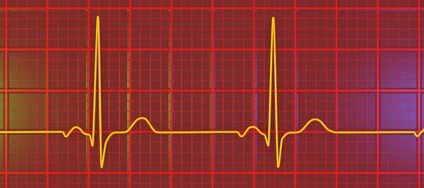 Normál Elektrokardiogram Ekg Illusztráció Amely Egészséges Egyénben Mutatja Szív Elektromos — Stock Fotó