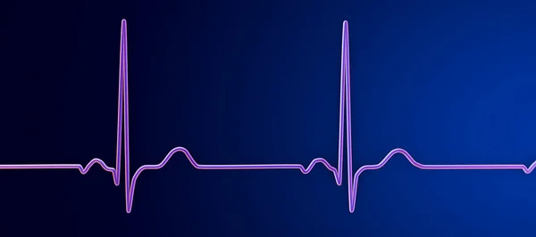 Electrocardiograma Ecg Normal Ilustración Que Muestra Actividad Eléctrica Del Corazón —  Fotos de Stock