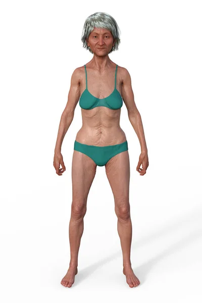 Illustration Female Body Ectomorph Body Type Characterized Lean Slender Build — Stock Photo, Image