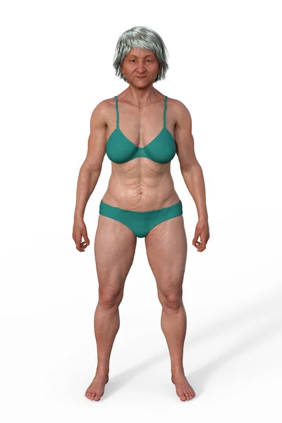 Ilustracja Kobiecego Ciała Mesomorfem Typu Ciała Charakteryzuje Się Muskularnym Wysportowanym — Zdjęcie stockowe