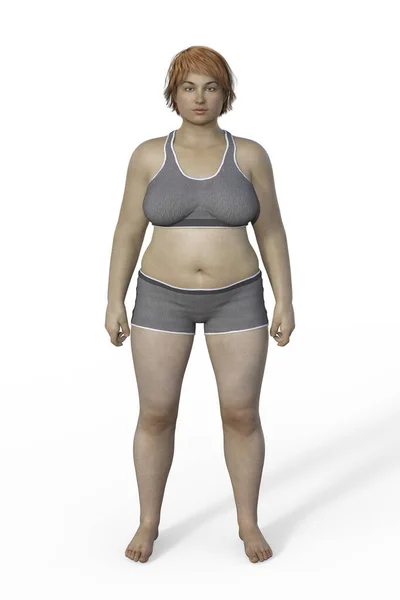 Illustration Kvinnlig Kropp Med Endomorf Kroppstyp Kännetecknas Högre Procentandel Kroppsfett — Stockfoto
