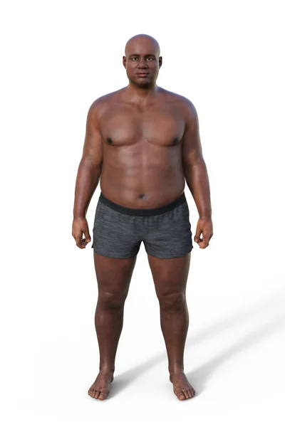 Uma Ilustração Corpo Masculino Com Tipo Corpo Endomorfo Caracterizado Por — Fotografia de Stock