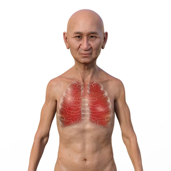 Photorealistic Illustration Showcasing Upper Half Part Man Transparent Skin Revealing — Stock Photo, Image