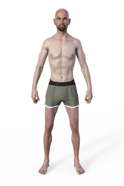 Illustration Male Body Endomorph Body Type Characterized Higher