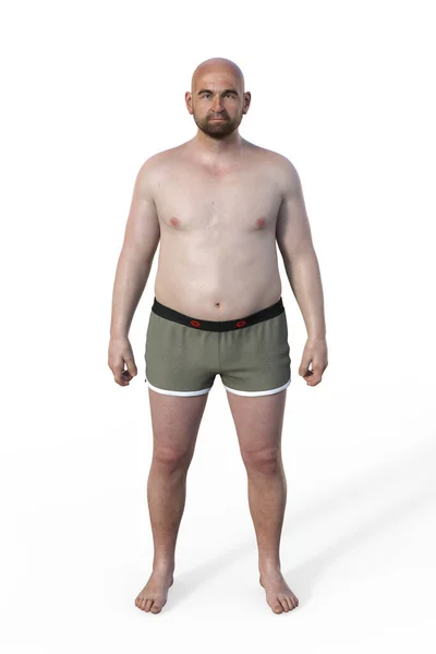 Illustration Male Body Endomorph Body Type Characterized Higher Percentage Body — Stock Photo, Image