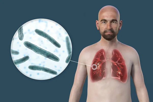 Fotorealistisk Illustration Den Övre Halvan Man Med Genomskinlig Hud Visa — Stockfoto