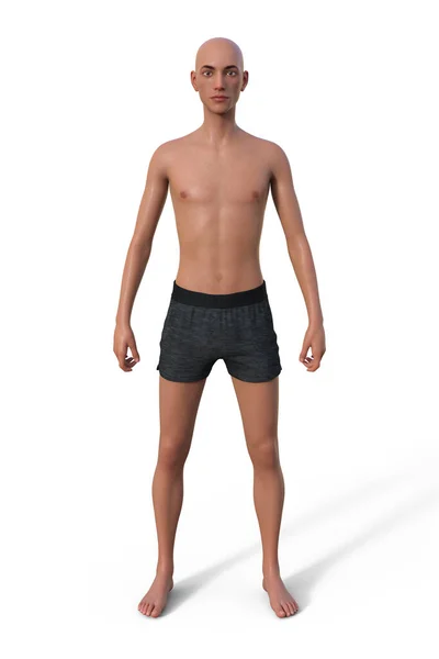 Illustration Male Body Endomorph Body Type Characterized Higher Percentage  Body Stock Photo by ©katerynakon 660008666