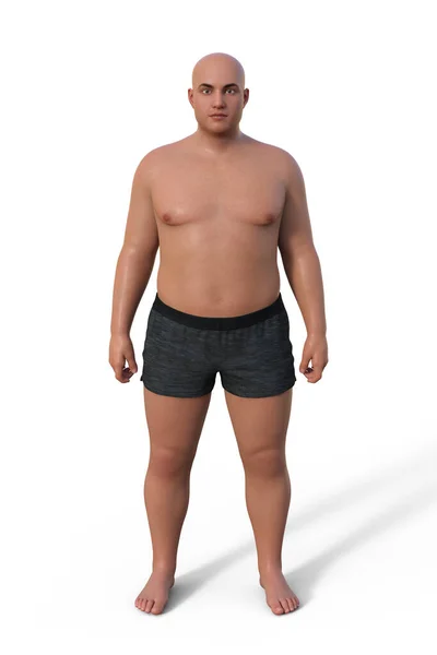 体脂肪の割合が高く丸みを帯びた形状が特徴のエンドルフィンボディタイプの男性体の3Dイラスト — ストック写真