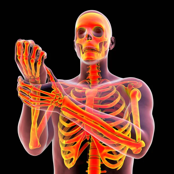 Homem Que Experimenta Dor Pulso Com Esqueleto Destacado Para Mostrar — Fotografia de Stock