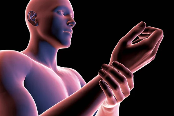 Man Experiencing Wrist Pain Conceptual Illustration — Stock Photo, Image