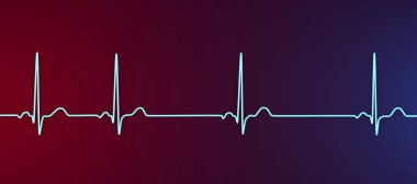 Sinüs aritmisini gösteren elektrokardiyogramın ayrıntılı bir 3D çizimi sinüs düğümünden kaynaklanan düzensiz kalp ritmiyle karakterize edilen bir durumdur..