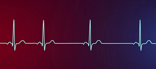stock image A detailed 3D illustration of an Electrocardiogram ECG displaying sinus arrhythmia, a condition characterized by irregular heart rhythms originating from the sinus node.