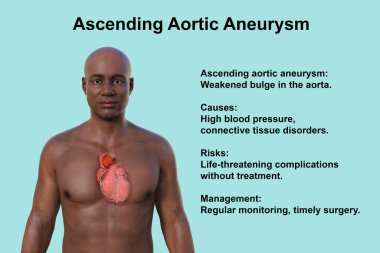 Şeffaf derili bir Afrikalı adamın üst kısmının 3 boyutlu fotorealistik bir çizimi, yükselen bir aort anevrizmasını ortaya çıkarıyor.