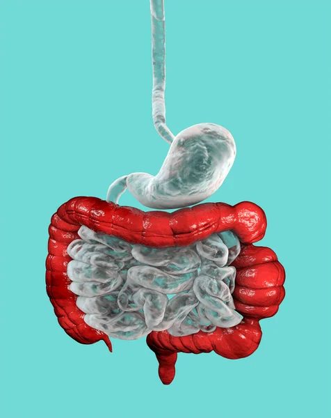 Medical Illustration Depicting Large Bowel Highlighted Spasms Showcasing Characteristic Feature — Stock Photo, Image