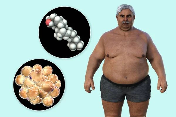 Medical Illustration Featuring Senior Overweight Man Close View Adipocytes Cholesterol — Stock Photo, Image