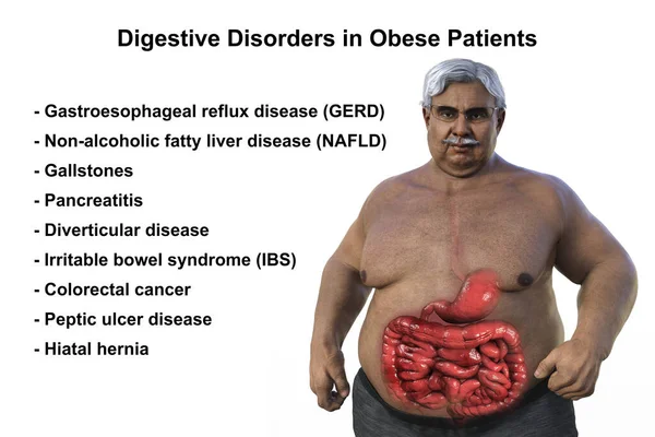 Detailed Medical Illustration Senior Overweight Man Transparent Skin Revealing Digestive — Stock Photo, Image