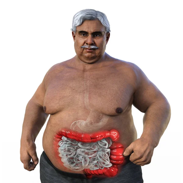 Senior Overweight Man Transparent Skin Showcasing Digestive System Highlighting Presence — Stock Photo, Image