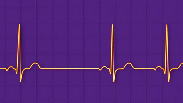 Detailed Illustration Electrocardiogram Ecg Displaying Sinus Arrhythmia Condition Characterized Irregular — Stock Photo, Image