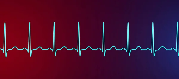 Illustrazione Dettagliata Elettrocardiogramma Ecg Che Mostra Tachicardia Sinusale Ritmo Cardiaco — Foto Stock