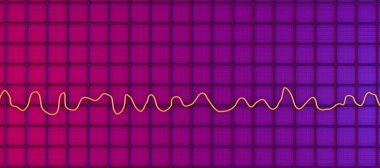 Ventriküler fibrilasyonun kaotik ritmini gösteren elektrokardiyogramı gösteren 3 boyutlu bilimsel bir illüstrasyon. Hayati tehdit eden kardiyak aritmi..