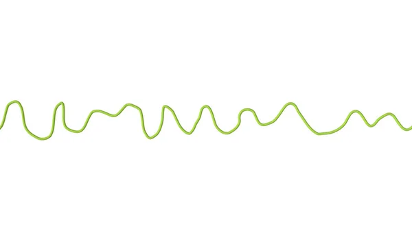 Ventriküler Fibrilasyonun Kaotik Ritmini Gösteren Elektrokardiyogramı Gösteren Boyutlu Bilimsel Bir — Stok fotoğraf