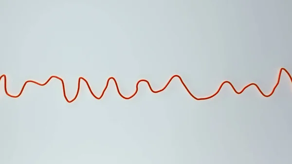 Illustrazione Scientifica Raffigurante Elettrocardiogramma Ecg Che Mostra Ritmo Caotico Della — Foto Stock