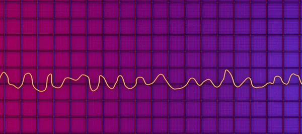 Vědecká Ilustrace Zobrazující Elektrokardiogram Ekg Zobrazující Chaotický Rytmus Fibrilace Komor — Stock fotografie