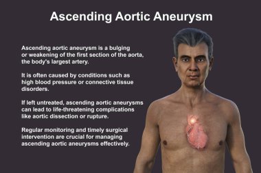 Şeffaf derisi olan yaşlı bir adamın üst kısmının 3 boyutlu fotorealistik bir çizimi, yükselen bir aort anevrizmasını ortaya çıkarıyor..