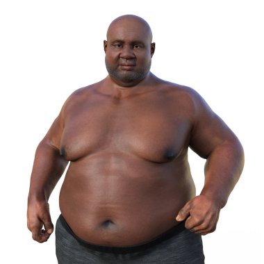 Aşırı kilolu bir Afrikalı adam, aşırı kilonun fizyolojik etkilerini vurgulayan 3 boyutlu tıbbi illüstrasyon.