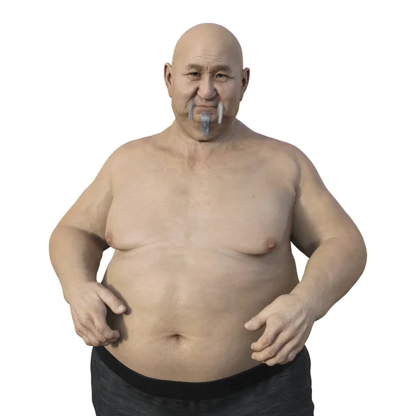 Illustrazione Scientifica Uomo Asiatico Anziano Sovrappeso Evidenziando Parte Superiore Del — Foto Stock