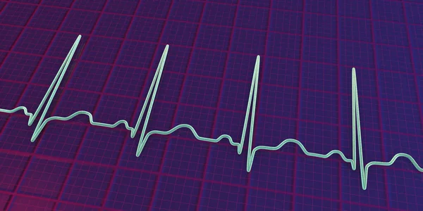 心电图心电图显示窦性心动过速的详细三维图像 窦性心动过速是一种有规律的心率 高于成年人90 100 Bpm正常心率的上限 — 图库照片