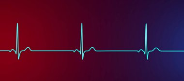 Sinüs bradikardisi gösteren bir elektrokardiyogramın detaylı bir 3D çizimi. Sinüs düğümünden kaynaklanan yavaş kalp atışlarıyla karakterize edilen bir durum. Genellikle dakikada 60 'ın altında..