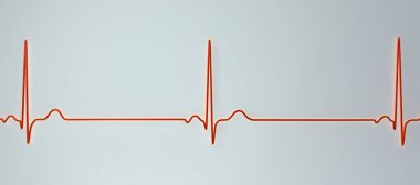 Sinüs bradikardisi gösteren bir elektrokardiyogramın detaylı bir 3D çizimi. Sinüs düğümünden kaynaklanan yavaş kalp atışlarıyla karakterize edilen bir durum. Genellikle dakikada 60 'ın altında..