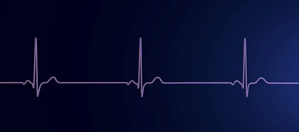 Sinüs Bradikardisi Gösteren Bir Elektrokardiyogramın Detaylı Bir Çizimi Sinüs Düğümünden — Stok fotoğraf