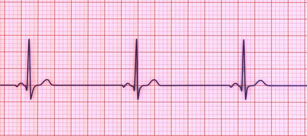 심전도를 심전도의 세부적 정맥동 결절에서 시작되는 심박수가 것으로 특징을 이루는 — 스톡 사진