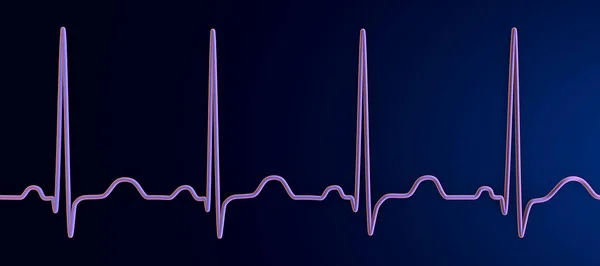 Подробная Трехмерная Иллюстрация Экг Электрокардиограммы Показывающая Тахикардию Пазухи Регулярный Сердечный — стоковое фото