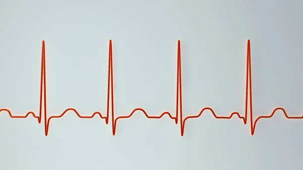心拍数が成人の通常の90100 Bpmの上限よりも高い心拍数を持つ通常の心臓リズムである副頻脈を示す心電図の詳細な3Dイラスト — ストック写真