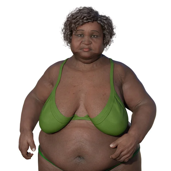 Kobieta Nadwagą Składu Ciała Ilustracji Medycznej Podkreślając Fizjologiczne Konsekwencje Nadwagi — Zdjęcie stockowe