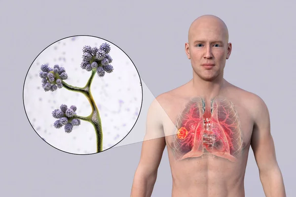 Photorealistic Illustration Upper Half Part Man Transparent Skin Revealing Lung — Stock Photo, Image