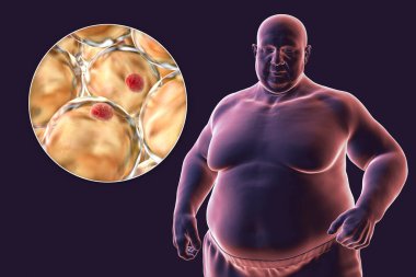 Aşırı kilolu bir adamı, adipositlere yakından bakarak, bu yağ hücrelerinin obezitedeki rolünü vurgulayan 3 boyutlu tıbbi bir çizim..