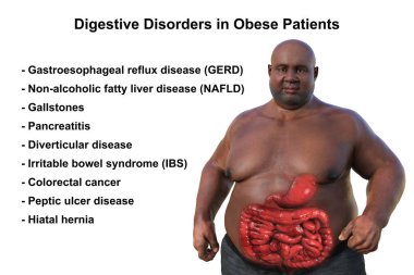 Aşırı kilolu, şeffaf derili, sindirim sistemini ortaya çıkaran ve obeziteyle ilişkili sindirim sorunlarını vurgulayan bir adamın detaylı üç boyutlu tıbbi çizimi..
