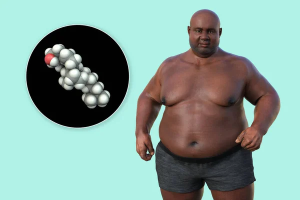 Illustrazione Medica Con Uomo Sovrappeso Con Una Visione Ravvicinata Una — Foto Stock