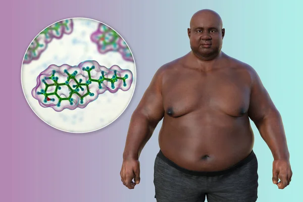 Medical Illustration Featuring Overweight Man Close View Cholesterol Molecule Highlighting — Stock Photo, Image