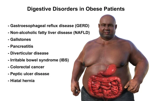 Aşırı Kilolu Şeffaf Derili Sindirim Sistemini Ortaya Çıkaran Obeziteyle Ilişkili — Stok fotoğraf