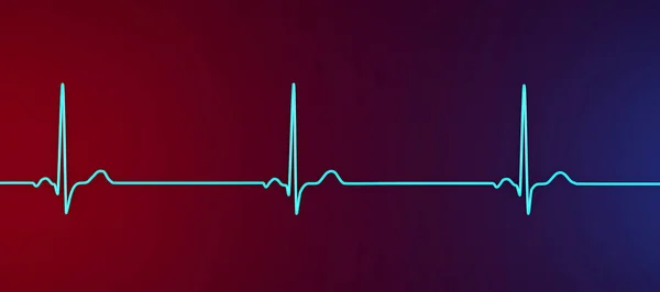 副徐脈を示す心電図の詳細な3Dイラスト 副徐脈から発生する遅い心拍数によって特徴付けられる状態 通常以下60分あたりのビート — ストック写真
