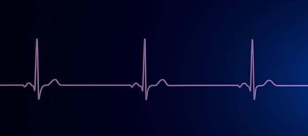Подробная Иллюстрация Электрокардиограммы Показывающая Синусовую Брадикардию Состояние Характеризующееся Медленным Сердечным — стоковое фото