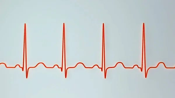Elektrokardiyogramın Detaylı Bir Çizimi Sinüs Taşikardisi Gösteriyor Kalp Ritmi Normal — Stok fotoğraf